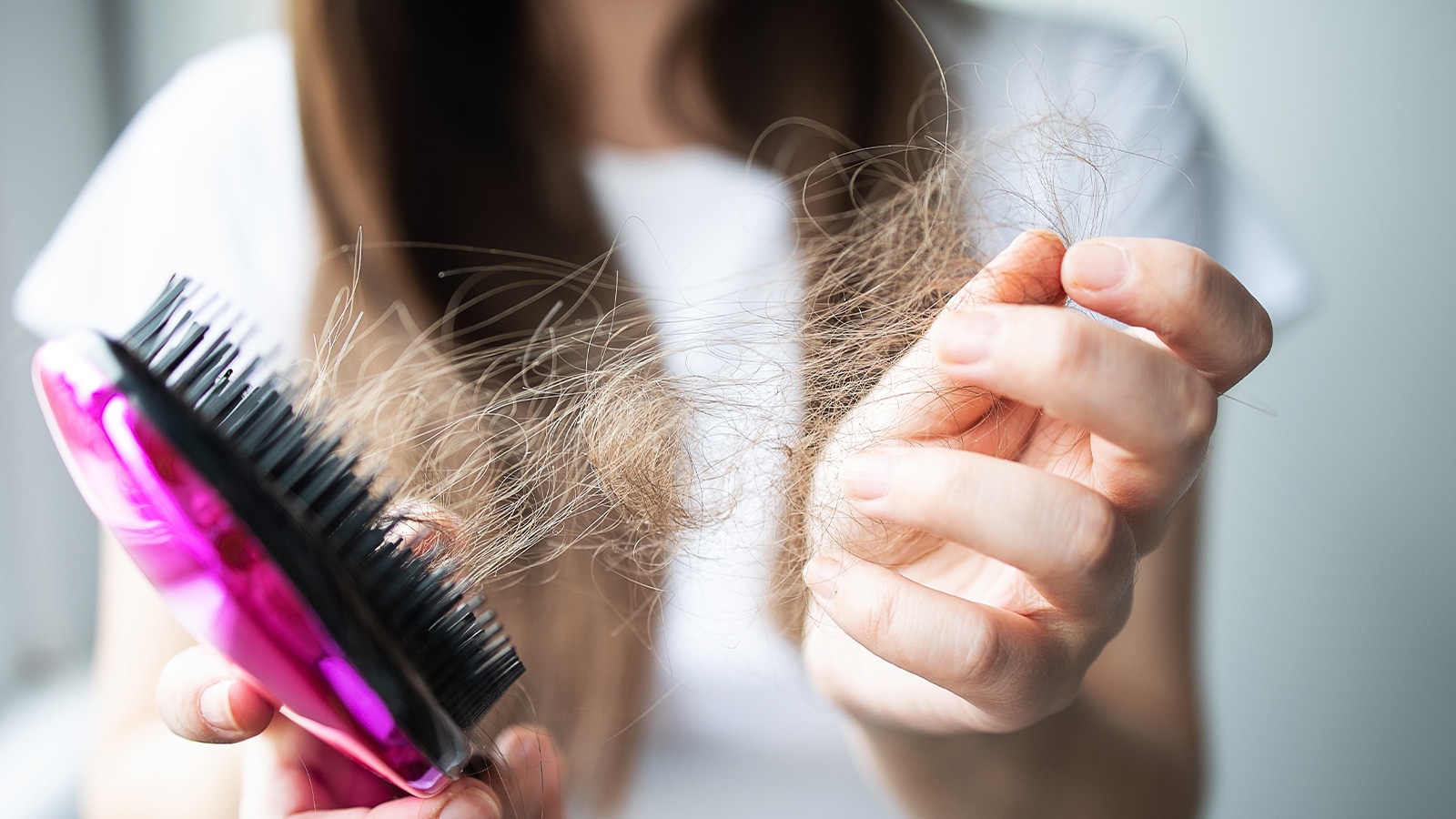 Featured image for “Does Stress Cause Hair Loss?”